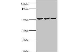 Western blot All lanes: Protein Z-dependent protease inhibitor antibody at 3 μg/mL Lane 1: Mouse liver tissue Lane 2: HepG2 whole cell lysate Lane 3: LO2 whole cell lysate Secondary Goat polyclonal to rabbit IgG at 1/10000 dilution Predicted band size: 51 kDa Observed band size: 51 kDa (SERPINA1 抗体  (AA 165-444))