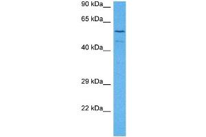 Host:  Rabbit  Target Name:  TLE1  Sample Tissue:  Mouse Spleen  Antibody Dilution:  1ug/ml (TLE1 抗体  (N-Term))