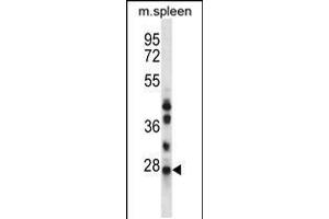 Western blot analysis in mouse spleen tissue lysates (35ug/lane). (NQO2 抗体  (N-Term))