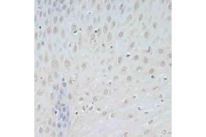 Immunohistochemistry (IHC) image for anti-Transcription Elongation Factor B (SIII), Polypeptide 2 (18kDa, Elongin B) (TCEB2) (AA 1-118) antibody (ABIN6148934)