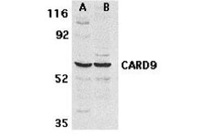 Western Blotting (WB) image for anti-Caspase Recruitment Domain Family, Member 9 (CARD9) antibody (ABIN1031698) (CARD9 抗体)
