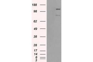 HEK293T cells were transfected with the pCMV6-ENTRY control (Left lane) or pCMV6-ENTRY BUB1B (Right lane) cDNA for 48 hrs and lysed. (BUB1B 抗体)