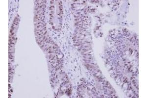 Image no. 1 for anti-Zinc Finger Protein 329 (ZNF329) (AA 1-202) antibody (ABIN1501837) (ZNF329 抗体  (AA 1-202))