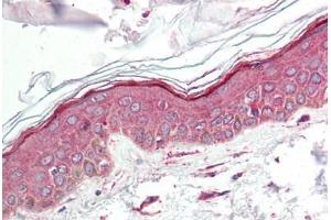 Human Skin (formalin-fixed, paraffin-embedded) stained with IL23A antibody ABIN214499 at 2. (IL23A 抗体  (N-Term))