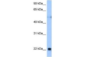 RTN4 antibody used at 0. (Reticulon 4 抗体  (Middle Region))