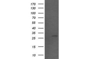 Image no. 1 for anti-Src-like-adaptor 2 (SLA2) antibody (ABIN1500952) (SLAP2 抗体)