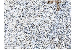 IHC analysis of NRF1 using anti-NRF1 antibody (ABIN7600874).