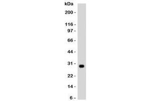Western blot testing of Ramos lysate and HLA-DRB1 antibody. (HLA-DRB1 抗体)