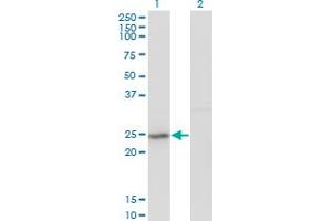 Western Blot analysis of GINS2 expression in transfected 293T cell line by Pfs2 monoclonal antibody (M02), clone 3H4. (GINS2 抗体  (AA 1-100))