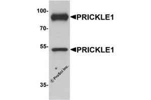 Western Blotting (WB) image for anti-Prickle-Like Protein 1 (PRICKLE1) (C-Term) antibody (ABIN1077370) (PRICKLE1 抗体  (C-Term))