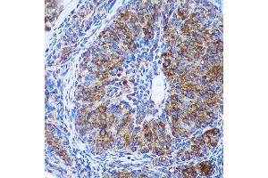 Immunohistochemistry (IHC) image for anti-GULP, Engulfment Adaptor PTB Domain Containing 1 (GULP1) (AA 1-130) antibody (ABIN6141541)