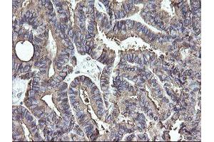 Image no. 5 for anti-Protein Disulfide Isomerase Family A, Member 3 (PDIA3) (AA 140-505) antibody (ABIN1490935)