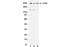 Western blot testing of ATM antibody and Lane 1:  rat testis (ATM 抗体  (N-Term))