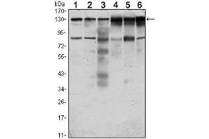 Western Blot showing PTK7 antibody used against Hela (1), A431 (2), HCT116 (3), Caco2 (4), HepG2 (5) and MCF-7 (6) cell lysate. (PTK7 抗体)