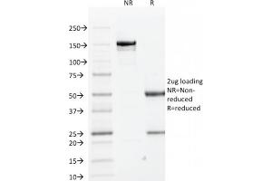 SDS-PAGE Analysis Purified Cytokeratin 1 Mouse Monoclonal Antibody (KRT1/1840). (Cytokeratin 1 抗体)