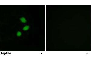Immunofluorescence analysis of MCF-7 cells, using TSHZ2 polyclonal antibody .