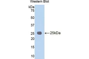 Western blot analysis of the recombinant protein. (IL1RAP 抗体  (AA 65-249))