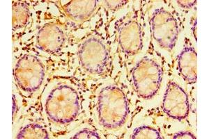 Immunohistochemistry of paraffin-embedded human colon tissue using ABIN7151699 at dilution of 1:100 (ERGIC3 抗体  (AA 47-341))