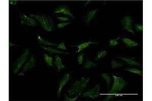 Immunofluorescence of monoclonal antibody to ABCB9 on HeLa cell.
