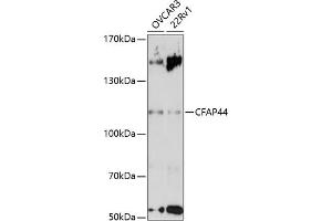 Western blot analysis of extracts of various cell lines, using CF antibody (ABIN7271360) at 1:3000 dilution. (WDR52 抗体  (AA 180-370))