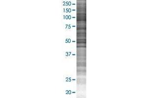 MRPL10 transfected lysate. (MRPL10 293T Cell Transient Overexpression Lysate(Denatured))