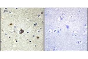 Immunohistochemistry (IHC) image for anti-Collagen, Type IV, alpha 3 (COL4A3) (AA 801-850) antibody (ABIN1534339)