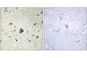 Immunohistochemistry analysis of paraffin-embedded human brain tissue, using Collagen IV alpha3 Antibody. (COL4a3 抗体  (AA 801-850))