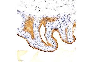 Immunohistochemistry analysis of paraffin embedded mouse bladder using TGDS (ABIN7075850) at dilution of 1: 1500 (TGDS 抗体)