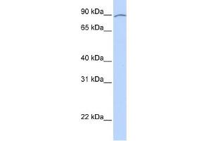 WB Suggested Anti-KIAA0317 Antibody Titration:  0. (AREL1 抗体  (Middle Region))