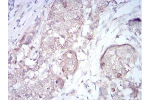 Immunohistochemistry (IHC) image for anti-rho Family GTPase 3 (RND3) (AA 104-241) antibody (ABIN5542672)