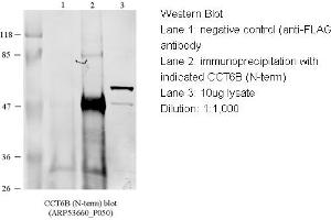 WB Suggested Anti-CCT4 Antibody Titration: 1 ug/mlLane 1: 10ug of HEK293 (CCT6B 抗体  (N-Term))