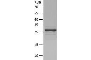 AUH Protein (AA 68-339) (His tag)