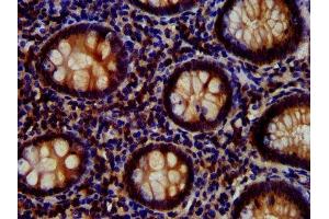 IHC image of ABIN7167024 diluted at 1:700 and staining in paraffin-embedded human appendix tissue performed on a Leica BondTM system. (AKT1 抗体  (AA 1-480))