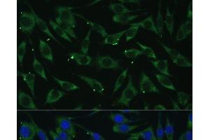 Immunofluorescence analysis of L929 cells using DICER1 Polyclonal Antibody at dilution of 1:100 (40x lens). (DICER1 抗体)