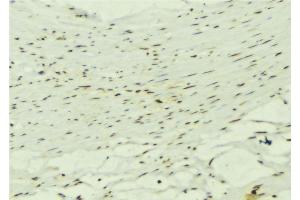 ABIN6272619 at 1/100 staining Mouse muscle tissue by IHC-P. (KALRN 抗体  (C-Term))