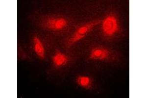 Immunofluorescent analysis of IKK beta (pS23) staining in PC12 cells.