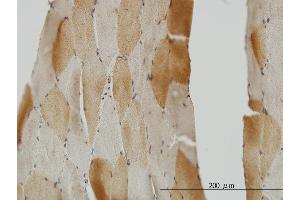 Immunoperoxidase of monoclonal antibody to CRYM on formalin-fixed paraffin-embedded human skeletal muscle. (CRYM 抗体  (AA 215-314))