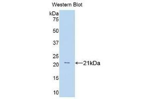 Detection of Recombinant TNFa, Rat using Polyclonal Antibody to Tumor Necrosis Factor Alpha (TNFa) (TNF alpha 抗体  (AA 80-235))