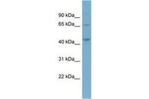 Image no. 1 for anti-Phosphatidylinositol-5-Phosphate 4-Kinase, Type II, alpha (PIP4K2A) (AA 287-336) antibody (ABIN6741987) (PIP4K2A 抗体  (AA 287-336))