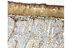 IHC-F testing of HSP70 antibody and rat intestine tissue