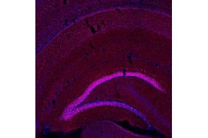 Indirect immunostaining of a PFA fixed mouse brain section (dilution 1 : 500; red). (BCL11B 抗体  (AA 1-151))