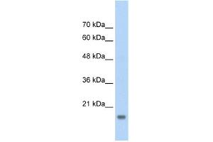 WB Suggested Anti-AMFR Antibody Titration:  2. (AMFR 抗体  (C-Term))