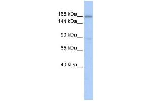 WB Suggested Anti-PBRM1 Antibody Titration: 0.
