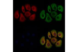 ABIN7094011 and ABIN7098055 staining Hela cells by IF/ICC. (TACO1 抗体  (Internal Region))