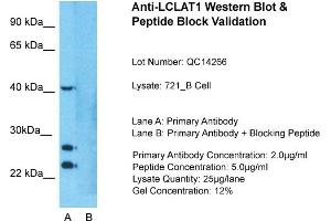 Host: Rabbit  Target Name: LCLAT1  Sample Tissue: Human 721_B cell  Lane A:  Primary Antibody Lane B:  Primary Antibody + Blocking Peptide Primary Antibody Concentration: 1 µg/mL Peptide Concentration: 5. (LCLAT1 抗体  (Middle Region))