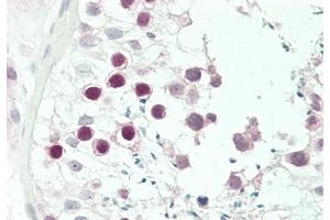 Formalin-fixed and paraffin-embedded H.