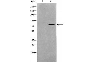 Western blot analysis on mouse brain cell lysate using DOK7 Antibody，The lane on the left is treated with the antigen-specific peptide. (DOK7 抗体  (C-Term))