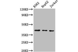 Western Blot Positive WB detected in: K562 whole cell lysate, HepG2 whole cell lysate, Jurkat whole cell lysate All lanes: CXCR3 antibody at 3 μg/mL Secondary Goat polyclonal to rabbit IgG at 1/50000 dilution Predicted band size: 41, 46, 29 kDa Observed band size: 41 kDa (CXCR3 抗体  (AA 4-50))