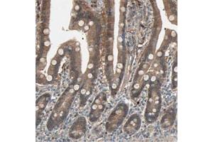 Immunohistochemical staining of human duodenum shows moderate cytoplasmic positivity in glandular cells. (SDSL 抗体)