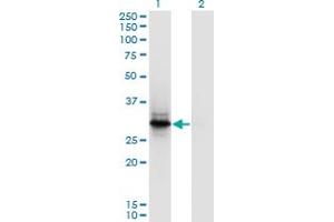 Western Blot analysis of FYCO1 expression in transfected 293T cell line by FYCO1 polyclonal antibody (A01). (FYCO1 抗体  (AA 1-255))